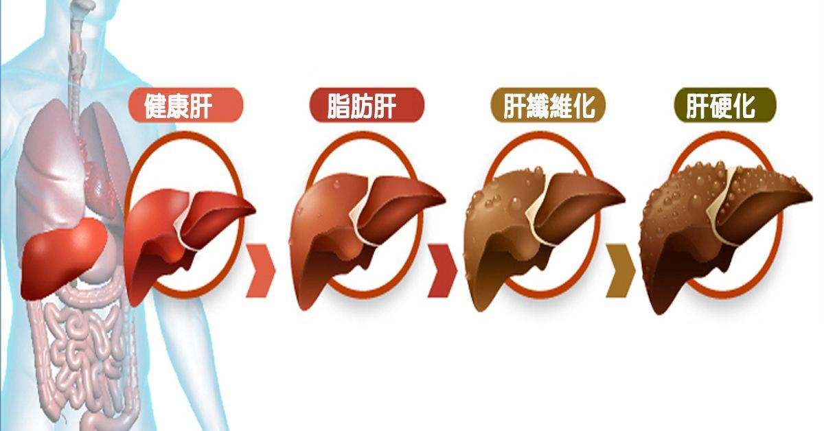 代用茶贴牌厂家